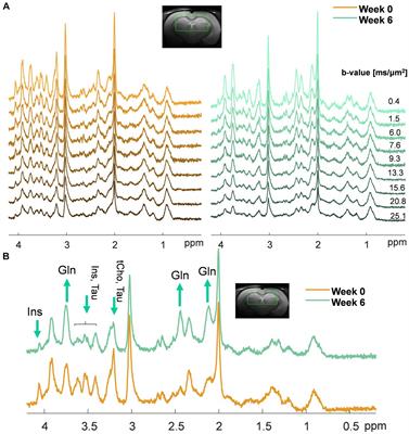 Diffusion of brain metabolites highlights altered brain microstructure in type C hepatic encephalopathy: a 9.4 T preliminary study